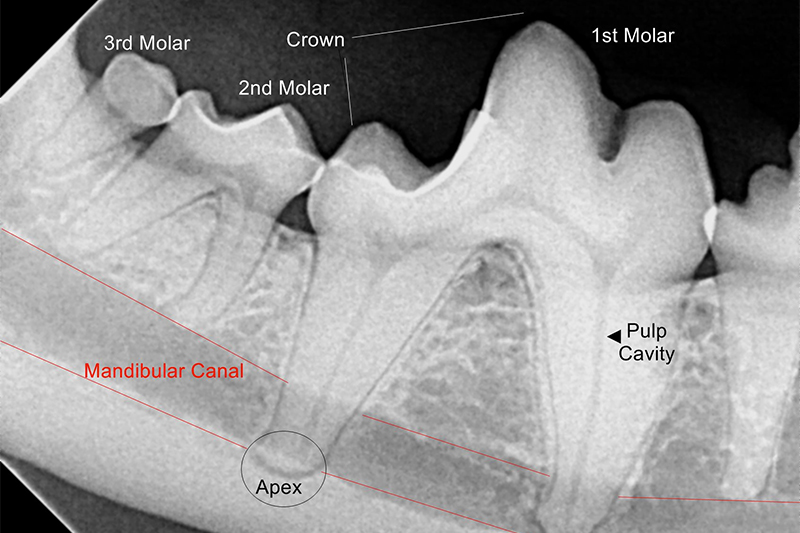 Teeth x-ray